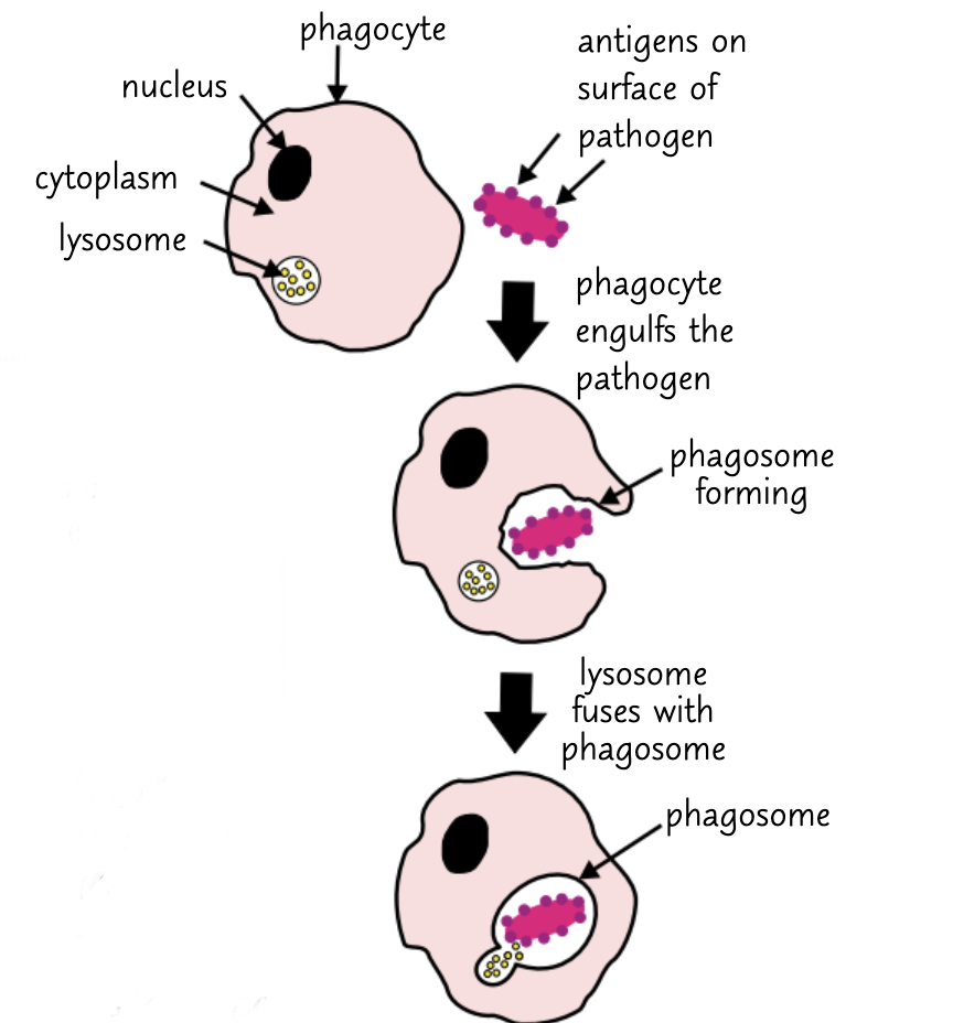 <p>1) A phagocyte (usually a macrophage) recognises the antigens on a pathogen.</p><p class="p1">2) The membrane and cytoplasm of the phagocyte move round the pathogen, engulfing it. This may be made easier by the presence of opsonins </p><p class="p1">3) The pathogen is now contained in a phagosome (a type of vesicle) in the cytoplasm of the phagocyte.</p><p class="p1">4) A lysosome (an organelle that contains digestive enzymes) fuses with the phagosome. The enzymes break down the pathogen.</p><p class="p1">5) The phagocyte then presents the pathogen's antigens. It sticks the antigens on its surface to activate other immune system cells. When a phagocyte does this it is acting as an antigen-presenting cell.</p>