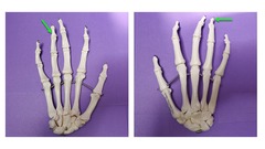 <p>specific bone name (multiple examples are indicated)</p>