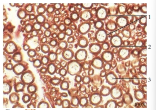 <p>A nerve stained with osmium</p>
