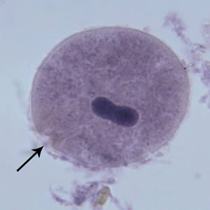 <p><strong>40-200 um</strong></p><p>Cilia on surface</p><p>Cytostome (arrow)</p><p><strong>Bean-shaped</strong> macronucleus</p><p>Cysts not often seen</p>