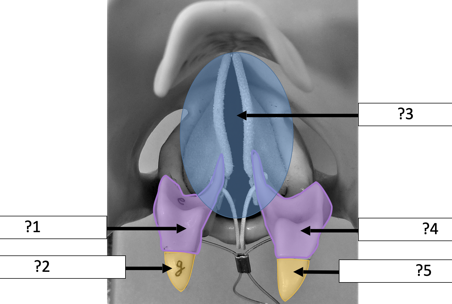 <p>5 Name the structure? </p>