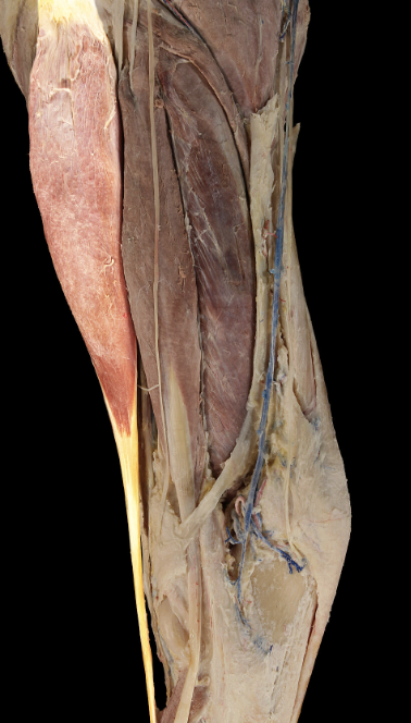 <p>which muscle is this</p>
