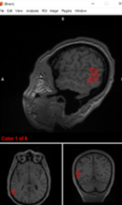 <p>visual cortex</p>