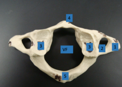 <p>C1; top vertebrae located between the bottom of the skull and C2</p>