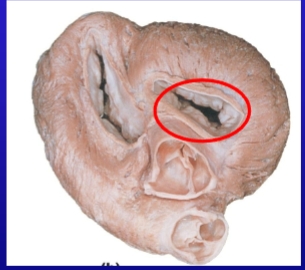 <p>Name the valve</p>