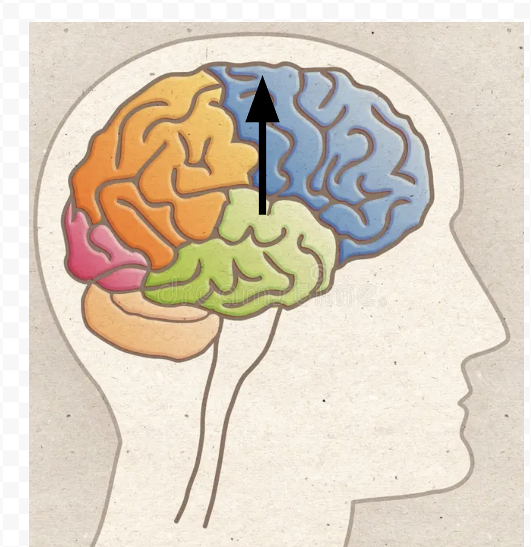 term image