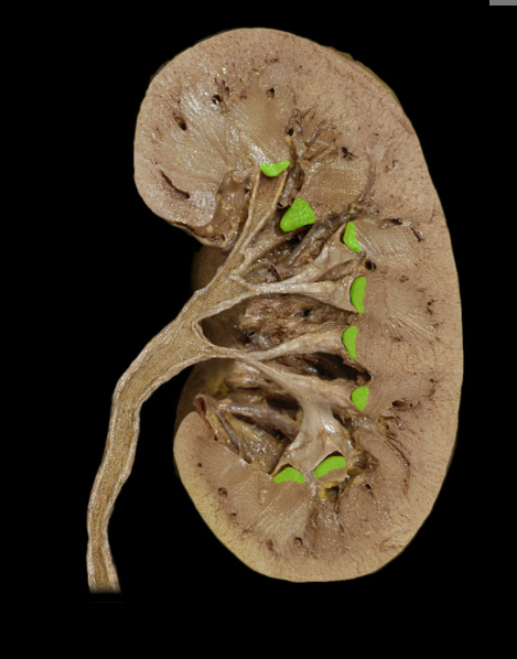 <p><span>Renal papilla</span></p>