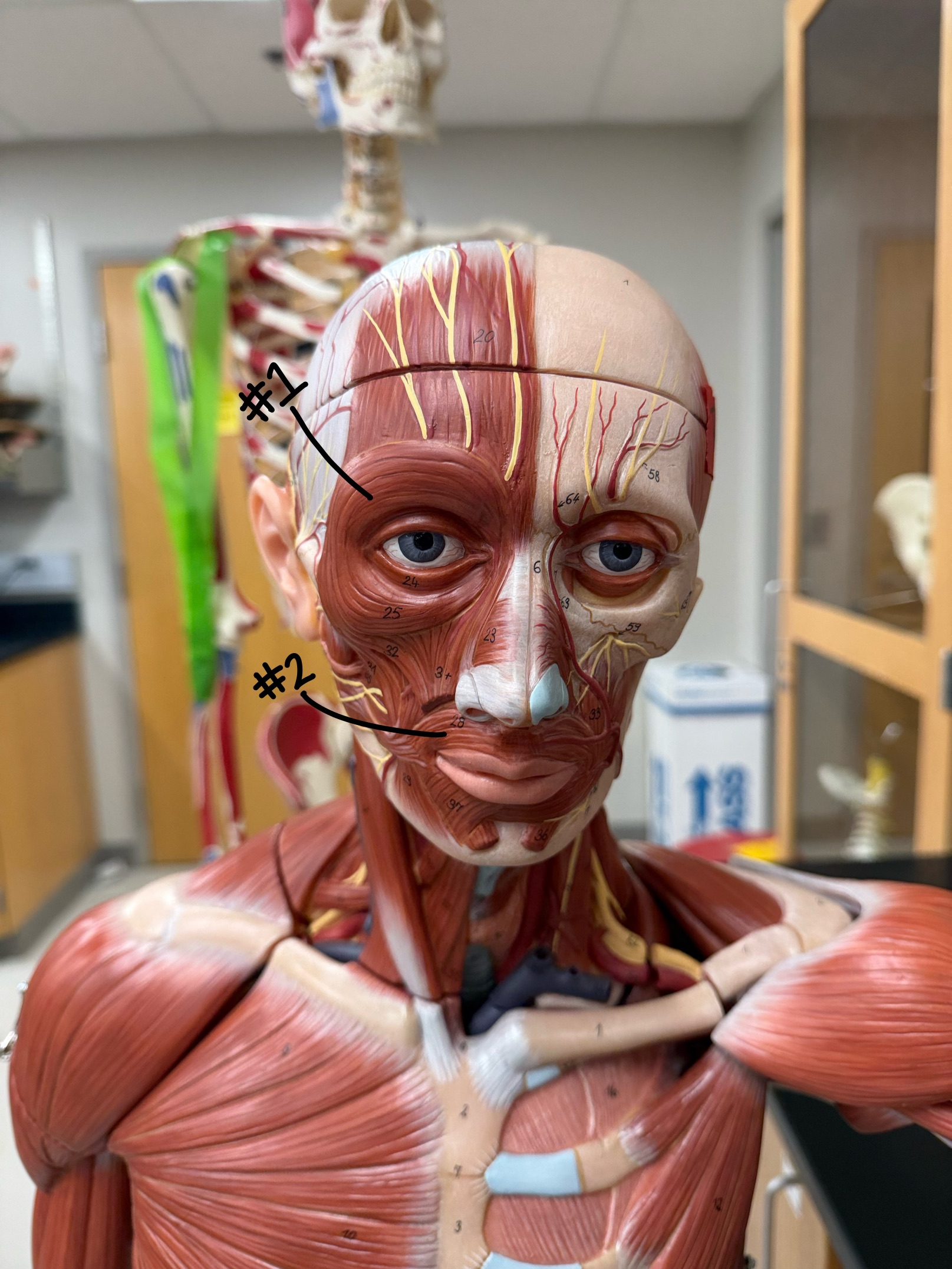 <p>What muscle is labeled at #1?</p>