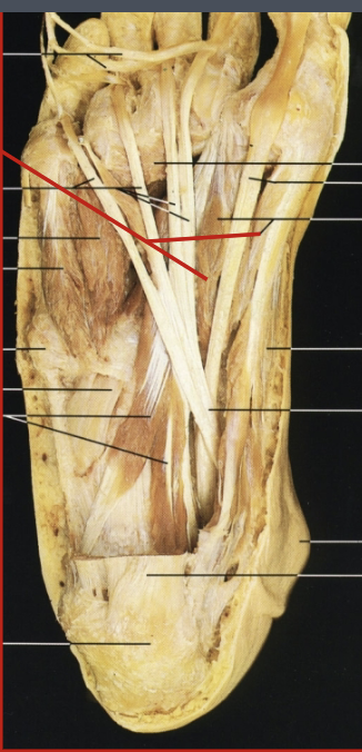 <p>What muscle, layer, action and innervation is this?</p>