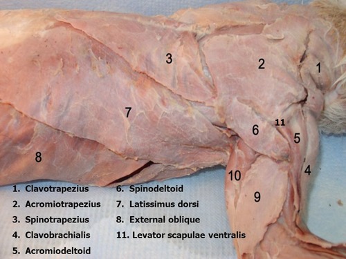 <p>Spinotrapezius</p>