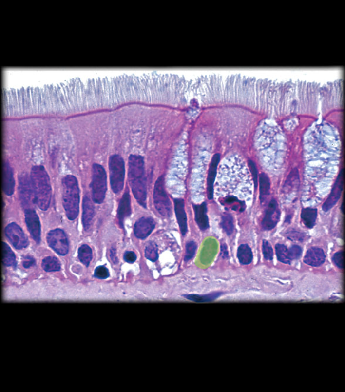 term image