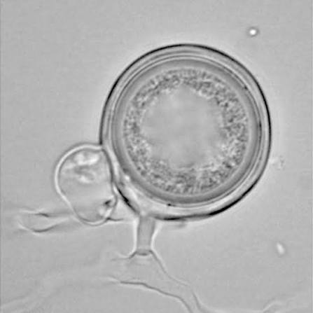 <p>thick-walled, resting spore of Phycomycetes</p>