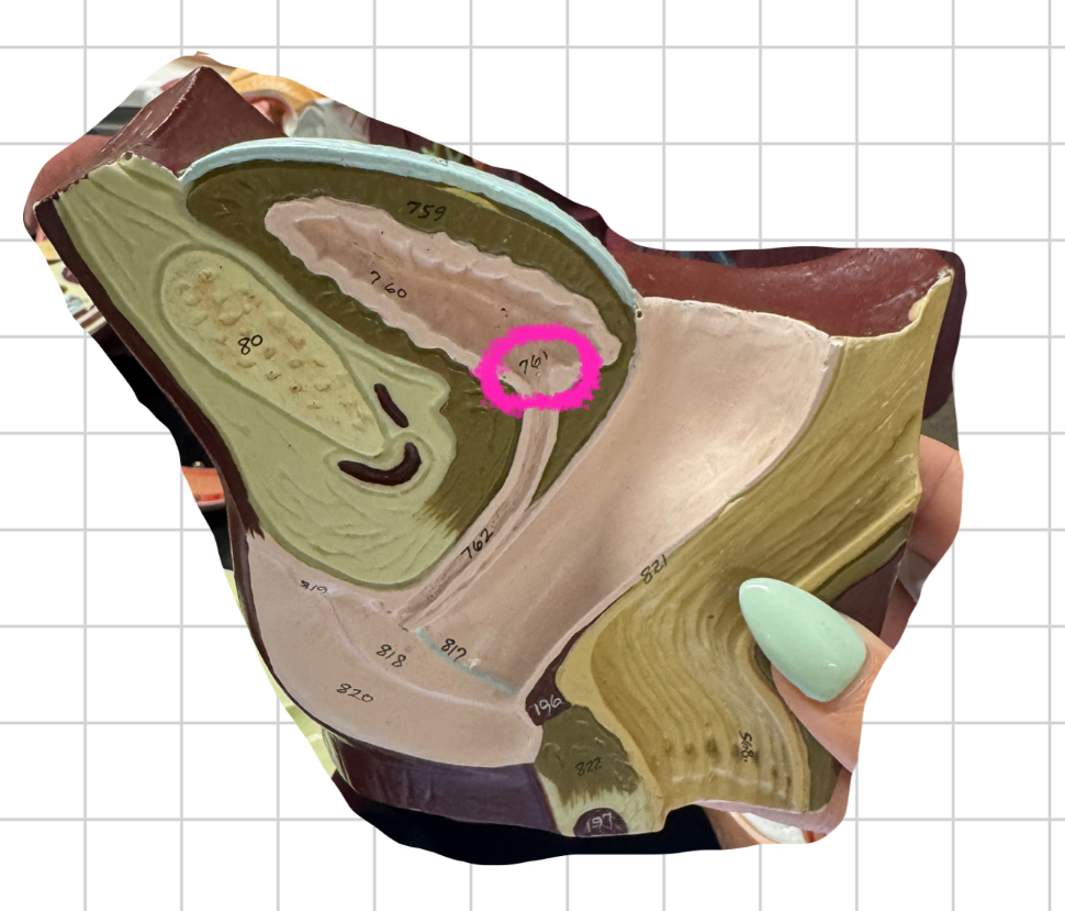term image