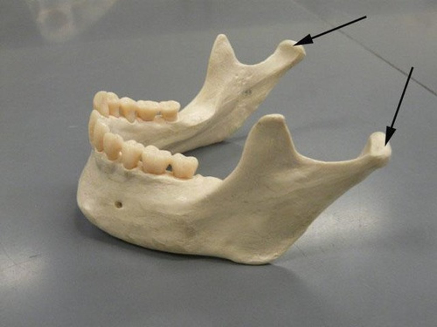 <p>ID structure(s) at tip of arrow</p>