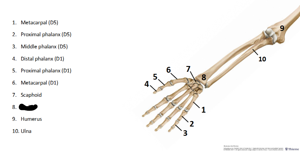 <p>What sturcture is this within the <strong>Upper-Appendicular?</strong></p>