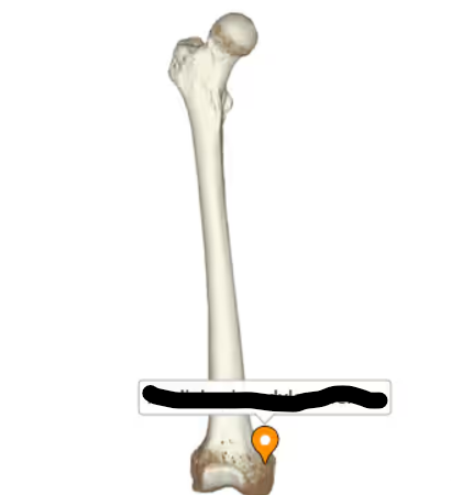 <p>What bone landmark is this within the <strong>Humerus </strong></p>