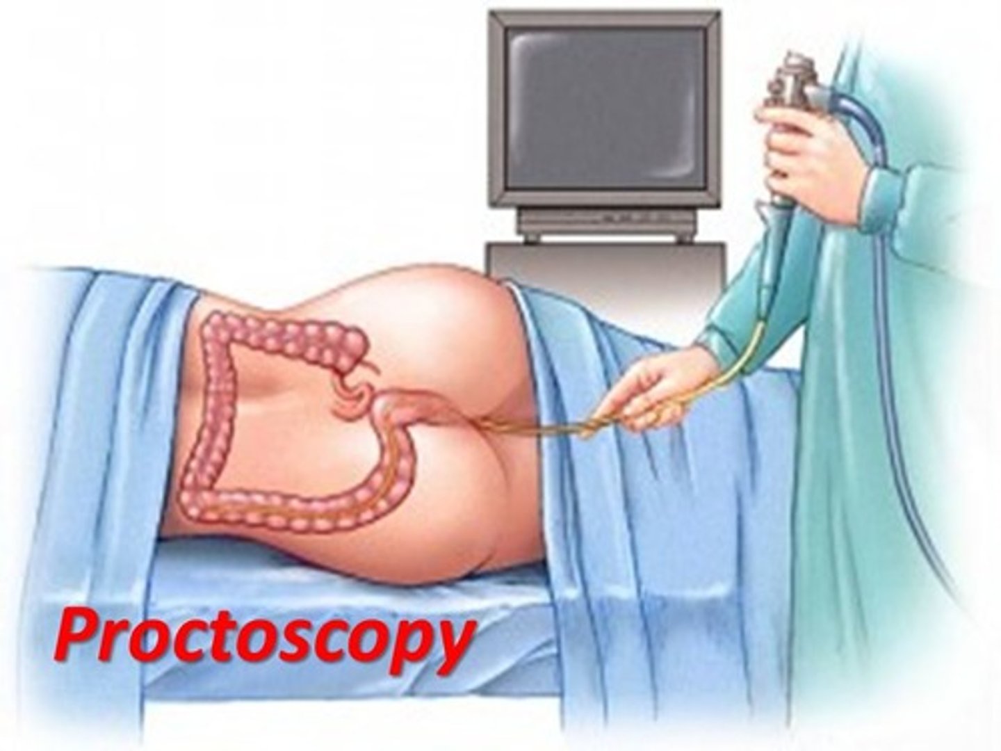 <p>proctoscopy</p>
