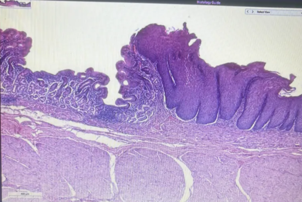<p>Identify structure &amp; which side</p>