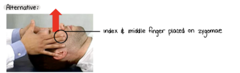<p>With a “plastic contact” on the bone, you apply a gentle anterior distraction (lift).</p><p>You pick up the slack until matching resistance is present at the sutures. Maintain this until an adequate release is felt bilaterally, indicated by less restriction and increased inherent motion felt at the zygomae.</p><p>You then gently release and reassess zygomatic motion.</p>