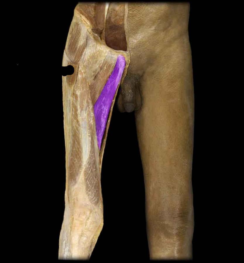 <p>What muscle is this?</p>