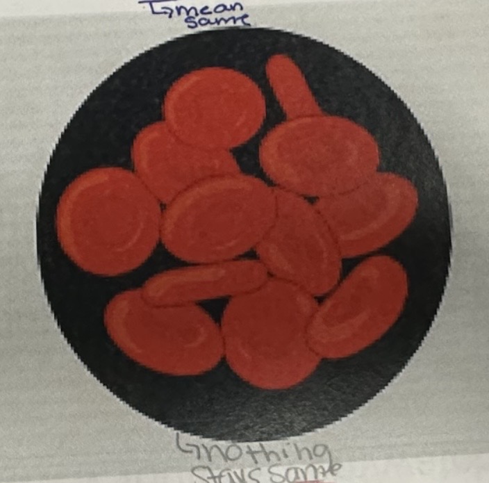 <p>Isotonic solution</p>