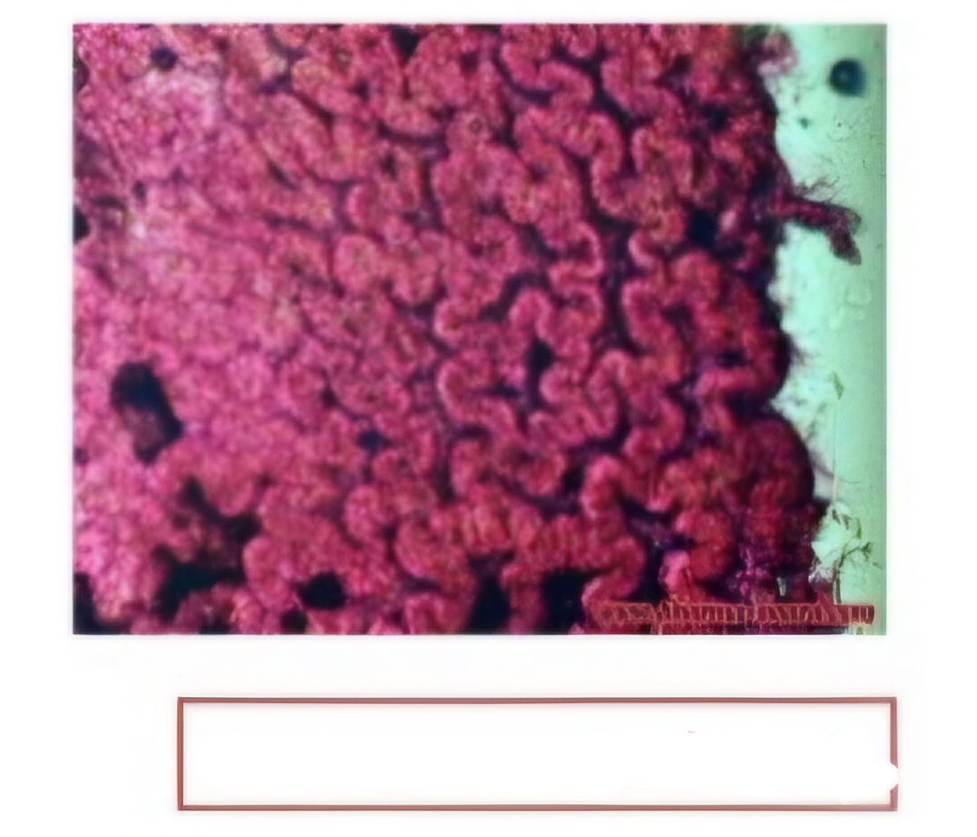 <p>What is this spot?</p>