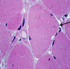 <p>cross section of</p>