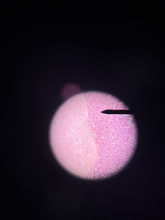 <p><span>This slide depicts which endocrine gland</span></p>