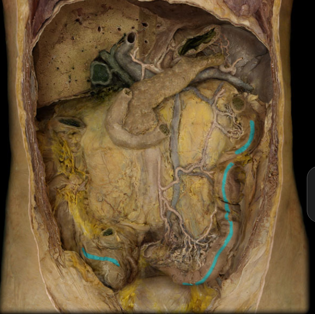 <p>the thing lil line along the colon that will split the row of haustra</p>
