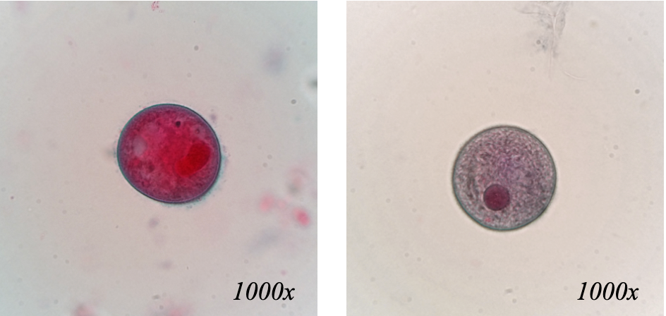 <p>What organism is this, and is it a trophozoite or a cyst?</p>