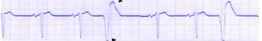 <p>what waveform is this</p>