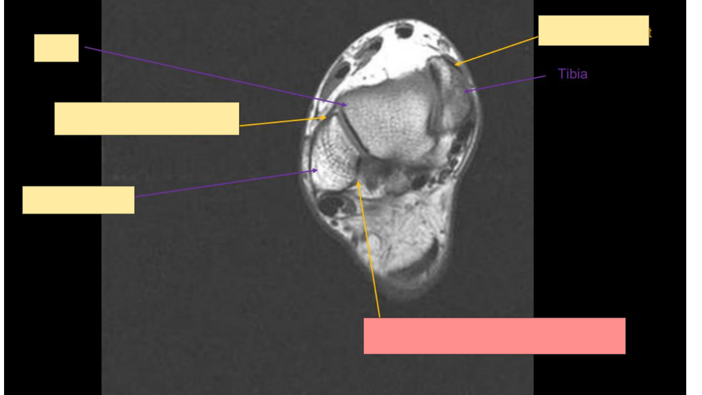 <p>Identify this structure</p>
