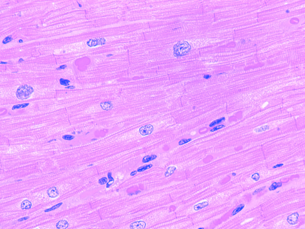 <p>-Function: Contracts involuntarily to pump blood throughout the body</p><p>-Found: Walls of the heart (myocardium)</p><p>-Description: Branched, striated cells with 1–2 nuclei and intercalated discs **look for intercalated disk to distinguish b/w skeletal**</p>