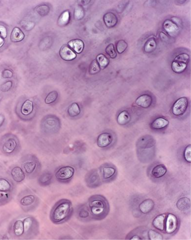 <p>What cartilage type is shown?</p>