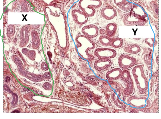 <p>identify y</p>