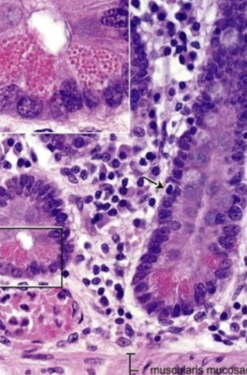 term image