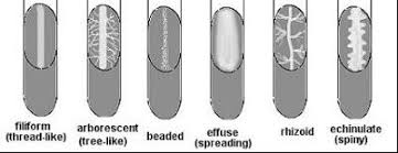 <p>Agar slant growth</p>