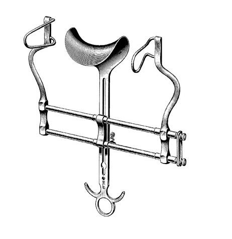 <p>Deep abdominal retraction during a laparotomy</p>