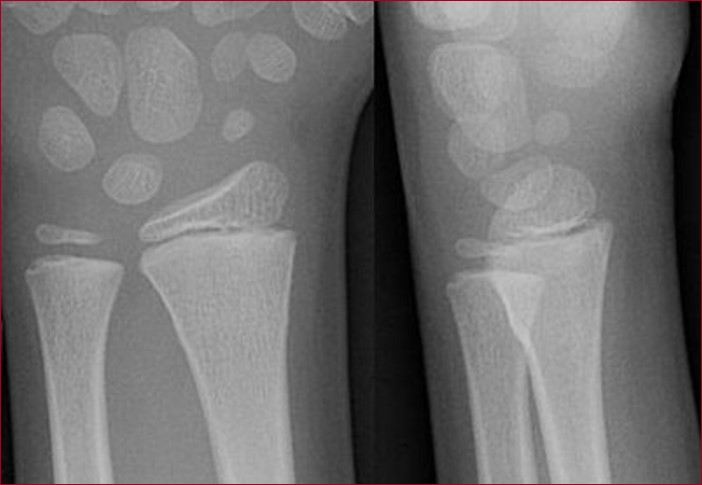 <p>What is the diagnosis?</p>