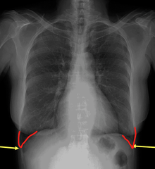 <p>Identify the structure</p>