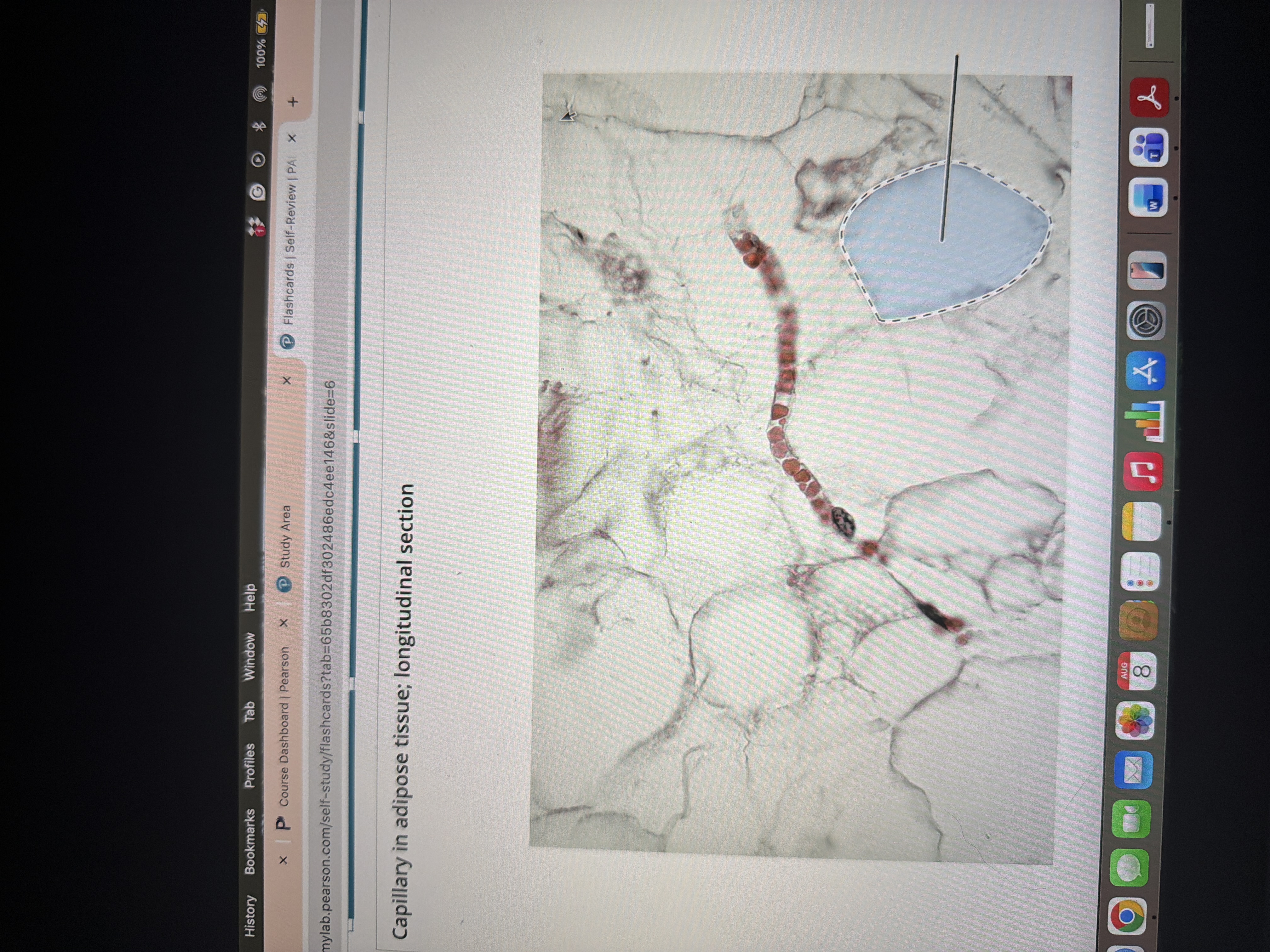 <p>Fat cell</p>