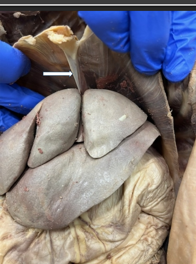 <p>What is the arrow pointing to? What two organs is it between?</p>