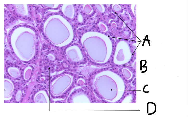 <p>what is B?</p>