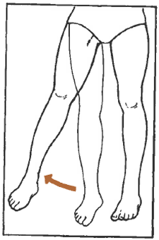 <p>Describe this motion?</p>