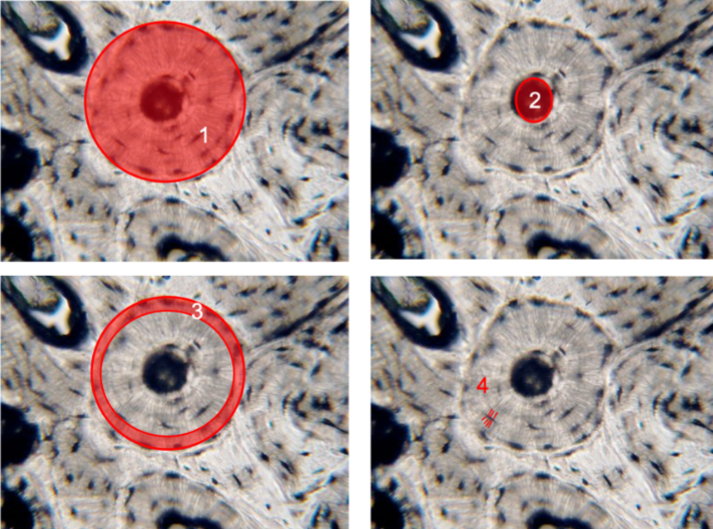<ol><li><p>osteons</p></li><li><p>central canal</p></li><li><p>concentric lamellae</p></li><li><p>canaliculi</p></li></ol><p></p>