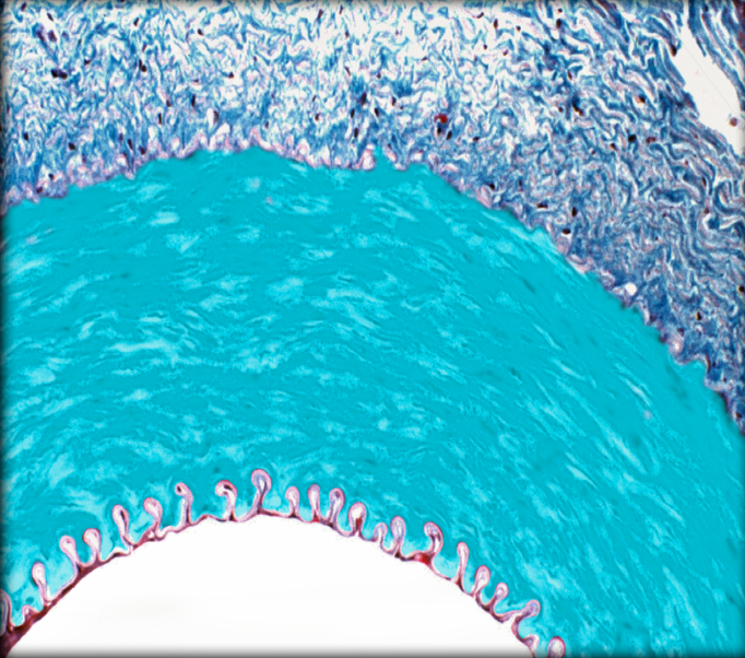 <ul><li><p><strong>Location: </strong>Middle layer of vessel wall</p></li><li><p><strong>Function: </strong>Vasoconstriction and vasodilation</p></li><li><p><strong>Description:</strong></p><ul><li><p>Circularly arranged smooth muscle layers and connective tissue</p></li><li><p>Fenestrated (perforated) elastic laminae between muscle cells</p></li><li><p>External limit formed by external elastic lamina</p></li></ul></li></ul><p></p>
