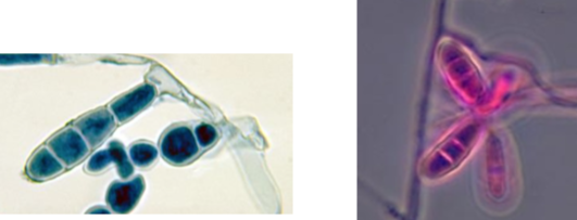 <p>microconidia: none<br>macroconidia: club shaped, “beaver tail” or “raquet” hyphae</p>