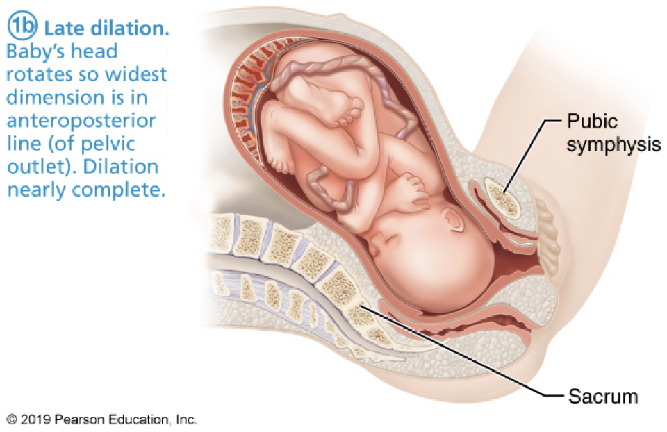 <p><strong>labor: dilation stage</strong></p><ul><li><p>longest stage</p></li><li><p>contractions 15-30 min apart, last for 10-30 seconds</p></li><li><p>dilation (widening) of ___ & effacement (thinning) of ___</p><ul><li><p>from pressure of ___</p></li><li><p>maximum diameter of 10cm</p></li></ul></li><li><p>engagement: ___</p></li></ul><p></p>