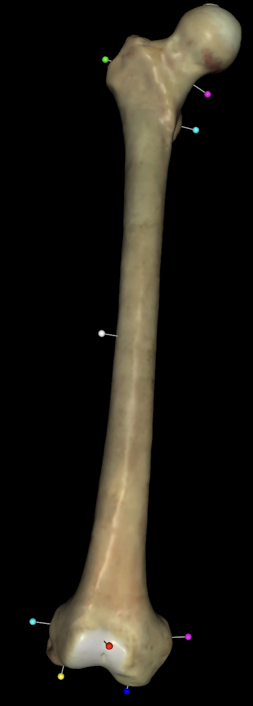 <p>what is the white tag on the right femurs?</p>