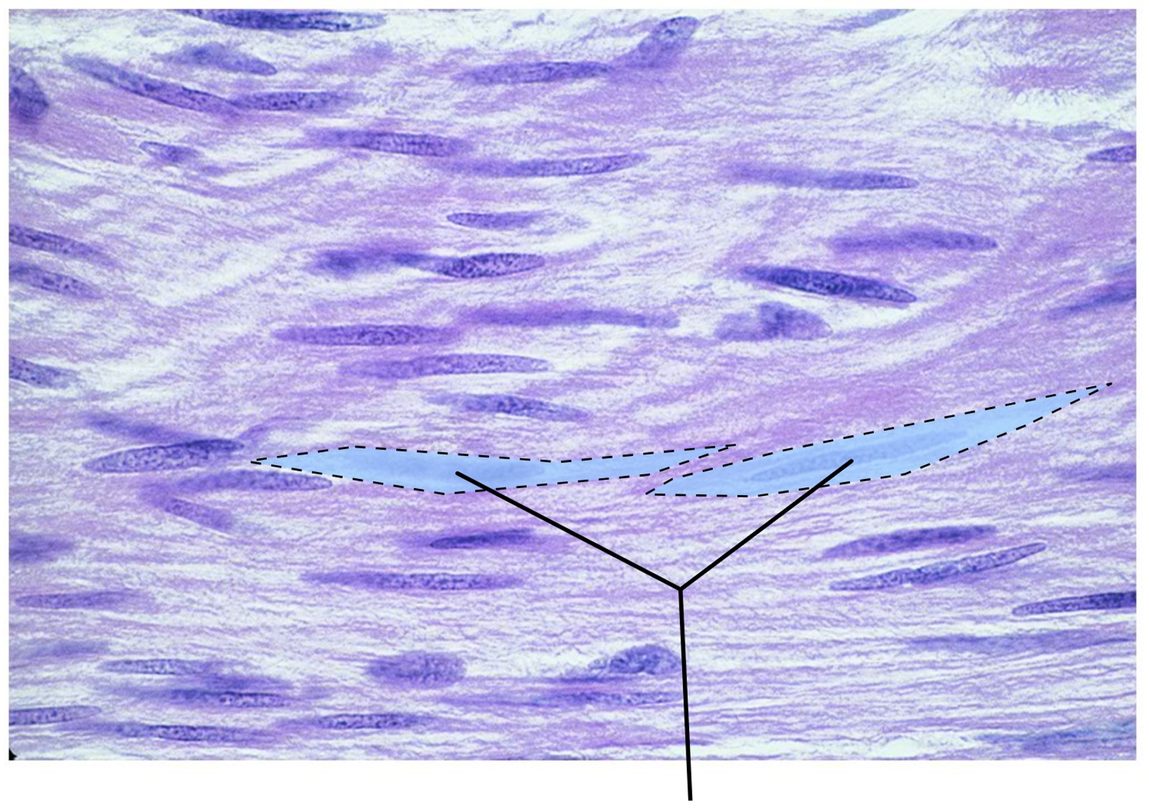<p><span>What tissue is highlighted in this image?</span></p>